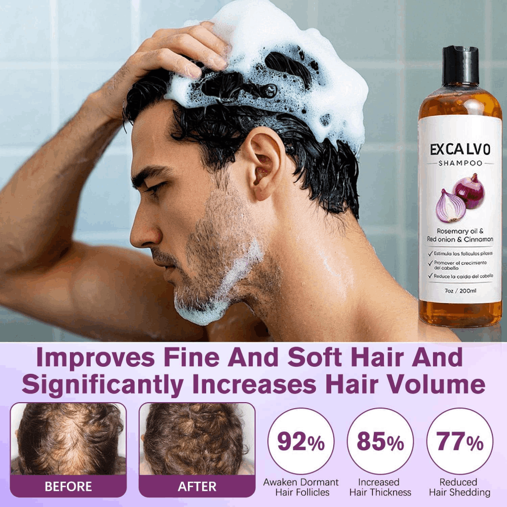 200ml Biberiye ve Kırmızı Soğa - Rosemary Hair Oil incelemesi ve fiyatı
