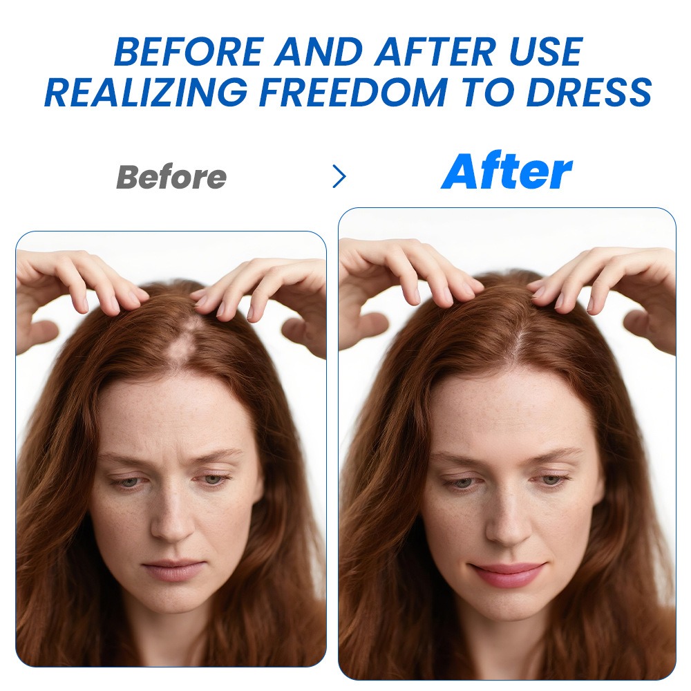 Alopesi Saç Çıkarma Spreyi Sop - Hair Care Spray incelemesi ve fiyatı