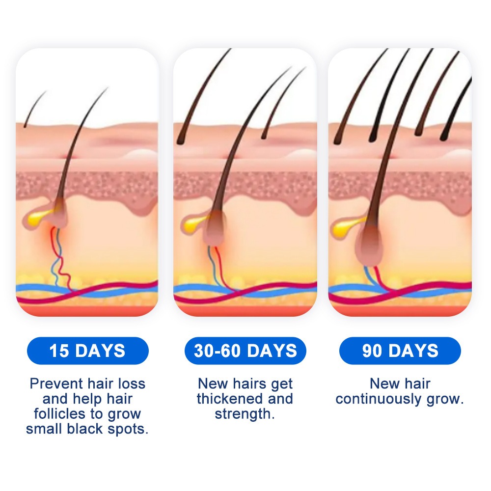 Alopesi Saç Çıkarma Spreyi Sop - Hair Care Spray incelemesi ve fiyatı