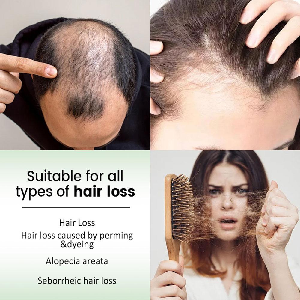 1/2 adet Biberiye Saç Şampuanı - Rosemary Hair Oil incelemesi ve fiyatı