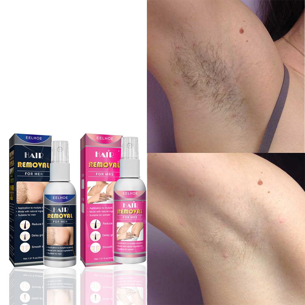 1/2 adet süper doğal ağrısız k - Hair Care Spray incelemesi ve fiyatı