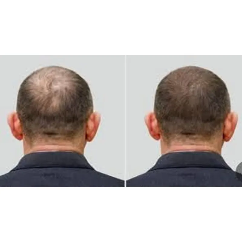 Saç Derisi ve Saç Bakım Tedavi - Hair Care Good Hair incelemesi ve fiyatı